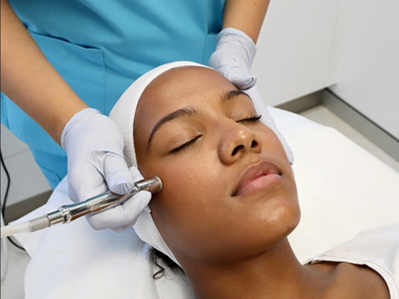 Microdermabrasion